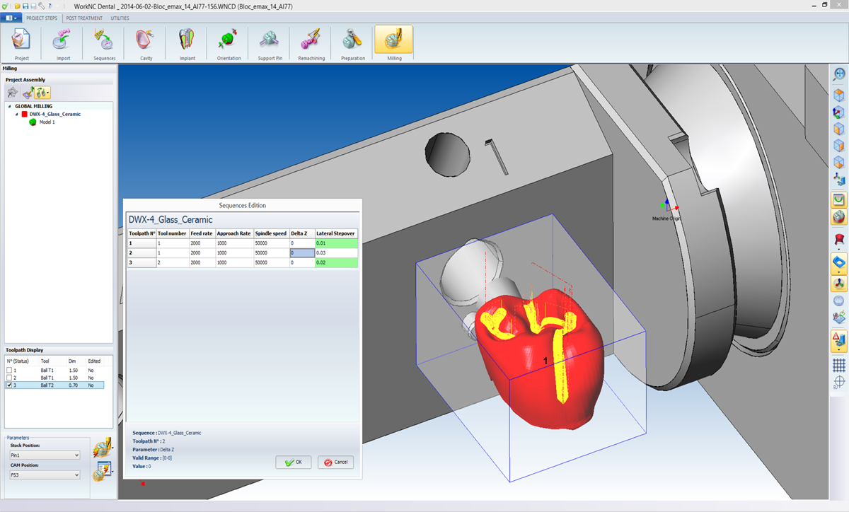 WORKNC DENTAL Automatic Preparation & Job Functions