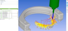 WORKNC Dental Gives Added Bite To Bruxism Patient, With Revolutionary New Material